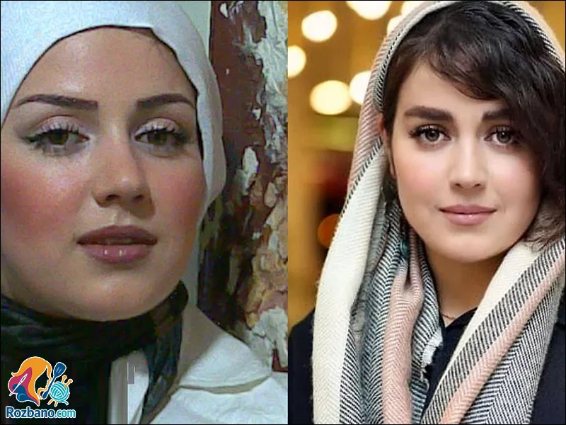عکس قبل و بعد از عمل زیبایی افسانه پاکرو