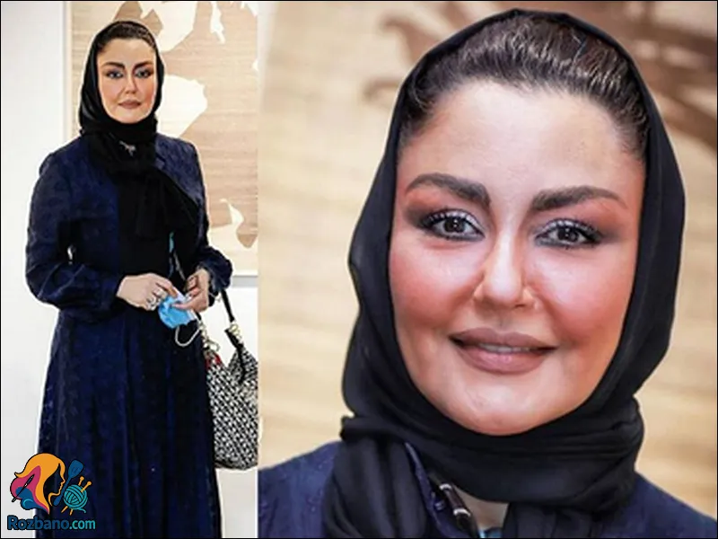 گالری عکس های جدید شقایق فراهانی قبل و بعد عمل