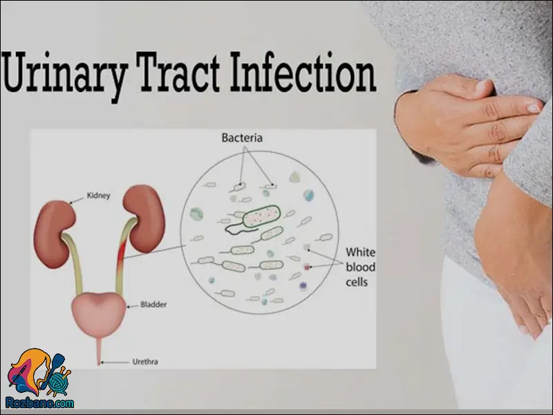 منشا عفونت های کلیه و مثانه در زنان باردار