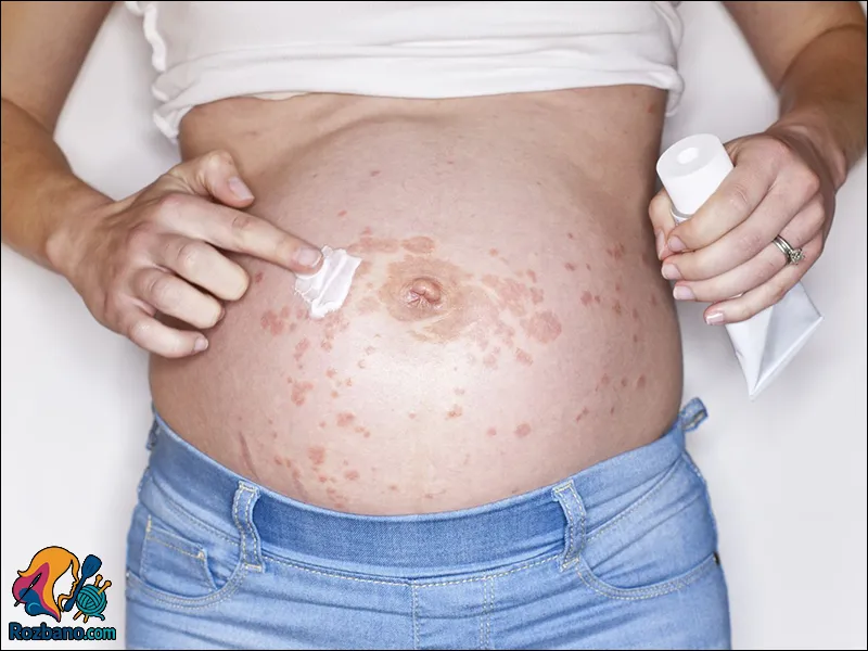 زیبایی پوست و مو در دوران بارداری و راه های مراقبت