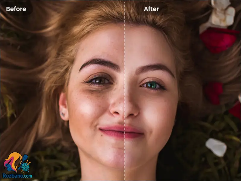 پوشاندن جوش های صورت فوری قبل از مهمانی