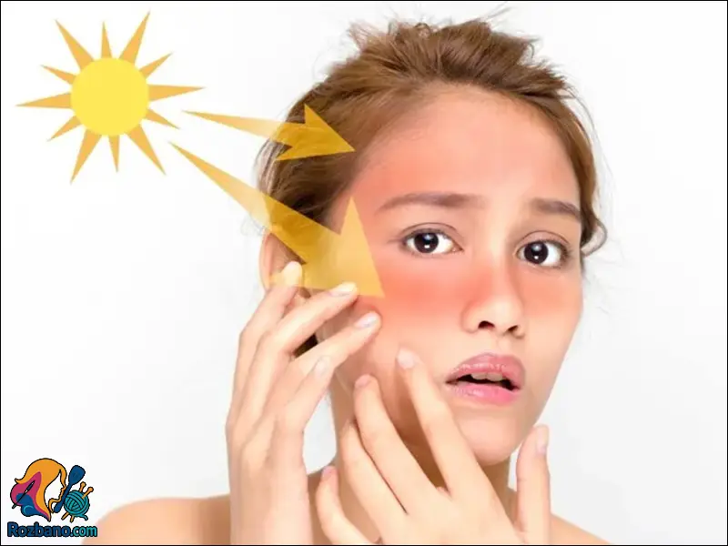 آفتاب سوختگی و خطرات آن در کودکان و بزرگسالان