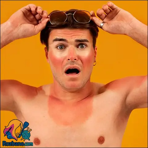 آفتاب سوختگی و خطرات آن روی پوست در ساحل