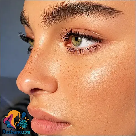 از بین بردن کک و مک صورت با روش های خانگی و پزشکی