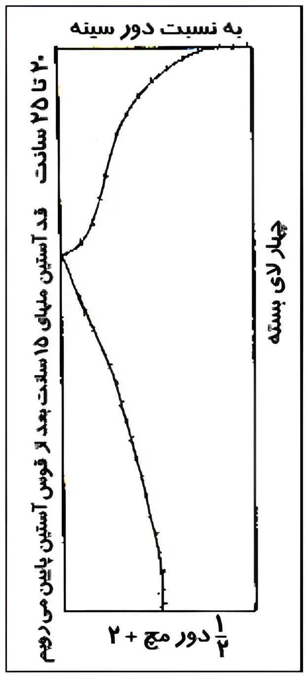 آموزش کامل دوخت آستين پفي به روش اصولي
