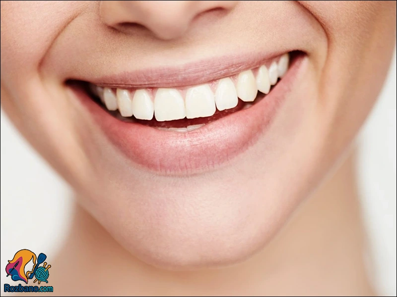 اصلاح طرح لبخند با ماندگاری بالا و مزایای فوق العاده