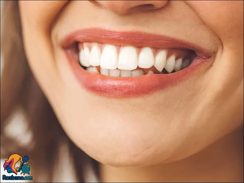 مراحل اصلاح طرح لبخند در کلینیک تخصصی
