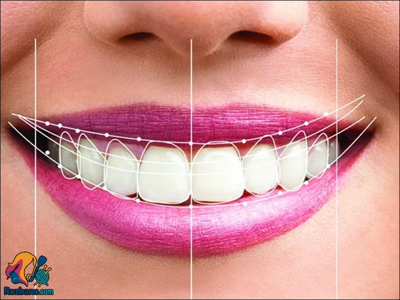 اصلاح طرح لبخند با بهترین روش ها