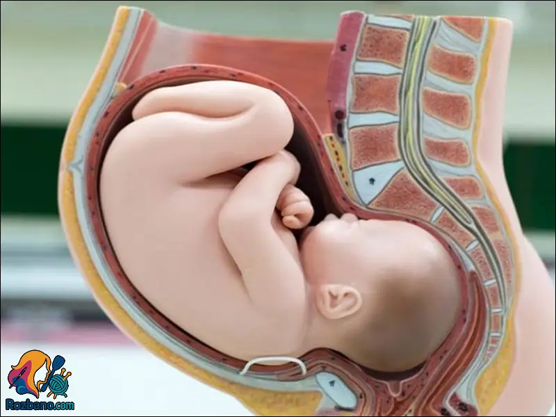 سركلاژ در بارداری چگونه انجام می شود کامل بخوانید