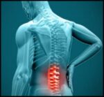 بررسی علت کمردرد و راه های درمان آن - Cause20of20low20back20pain20and20ways20of20treatment 02