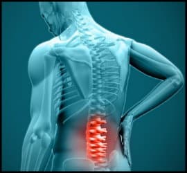 Cause20of20low20back20pain20and20ways20of20treatment-02