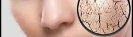Dry20face20skin-04