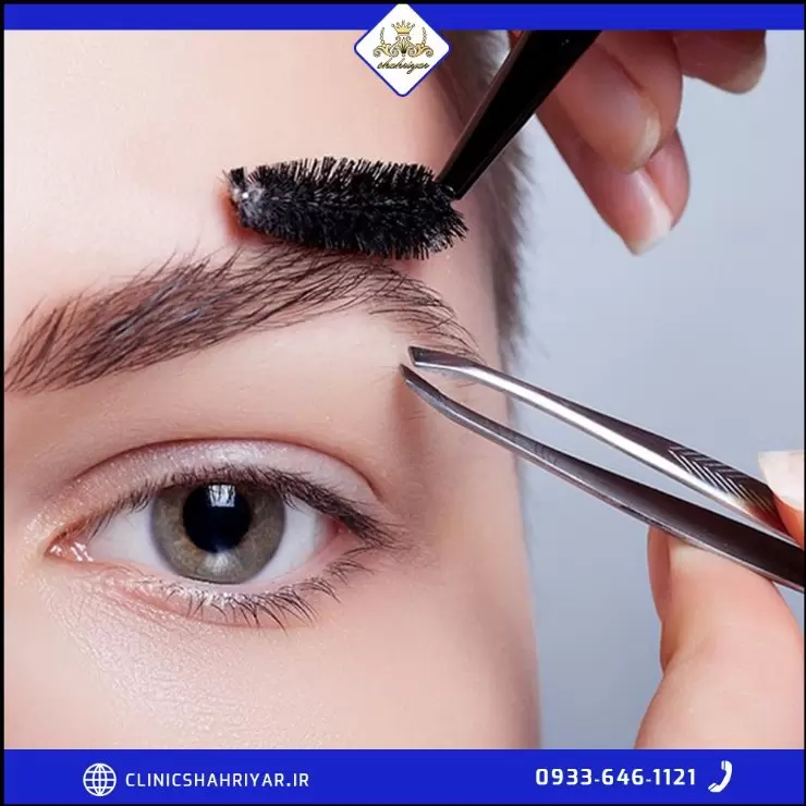 https://up.rozbano.com/view/3778245/Eyebrow%20transplantation-02.webp