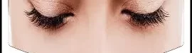 Eyebrow20transplantation-04