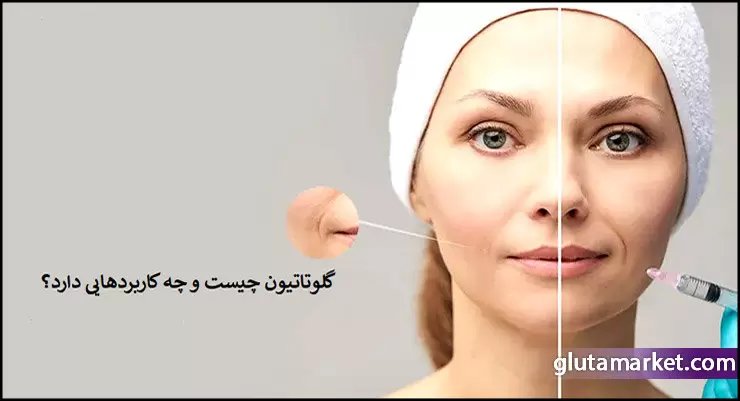 https://up.rozbano.com/view/3961231/Glutathione%20and%20improving%20skin%20tone%20and%20removing%20blemishes.webp
