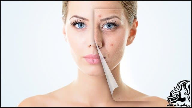 روش های برای داشتن پوستی عالی