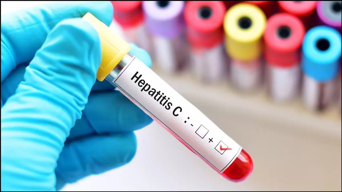 https://up.rozbano.com/view/3885261/Hepatitis%20prevention%20and%20treatment%20methods-01.webp