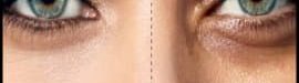 Homemade20mask20to20remove20dark20circles20under20the20eyes-01