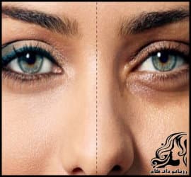 آموزش ساخت ماسک خانگی برای رفع سیاهی زیر چشم - Homemade20mask20to20remove20dark20circles20under20the20eyes 01