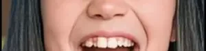 Invisible20orthodontics20for20children-04