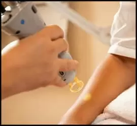 لیزر موهای زائد چگونه انجام میشود؟ پایان نگرانی شما - Laser20hair20removal 02