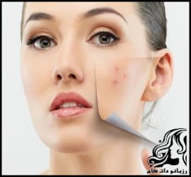 Making20a20homemade20anti-acne20mask-01