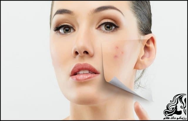https://up.rozbano.com/view/3318515/Making%20a%20homemade%20anti-acne%20mask.jpg