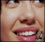 آموزش ساخت ماسک برای رفع تیرگی لب و گونه - Mask20to20remove20dark20circles20on20the20lips20and20cheeks 01