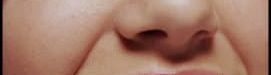 Mask20to20remove20dark20circles20on20the20lips20and20cheeks-01