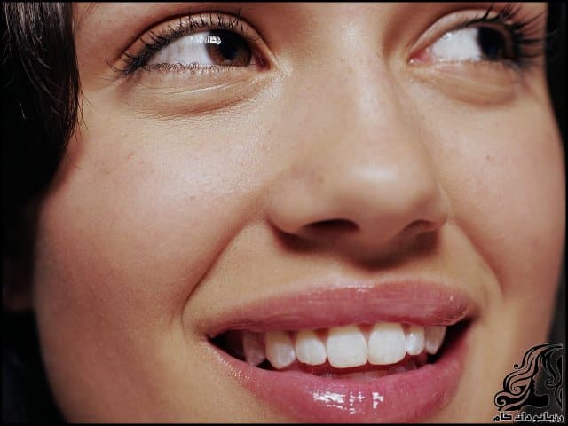 https://up.rozbano.com/view/3374750/Mask%20to%20remove%20dark%20circles%20on%20the%20lips%20and%20cheeks.jpg