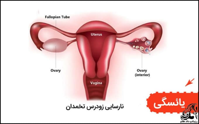 مقاله آموزشی درباره یائسگی و علائم آن و سن شروع