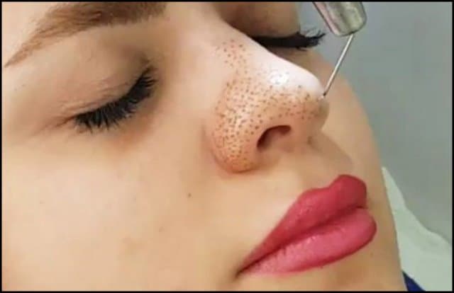 https://up.rozbano.com/view/3070776/Non-surgical%20techniques%20for%20facial%20skin%20rejuvenation-01.jpg