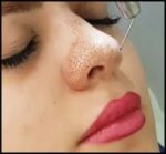 جدیدترین تکنیک های غیر جراحی جوانسازی و زیبایی پوست صورت - Non surgical20techniques20for20facial20skin20rejuvenation 02