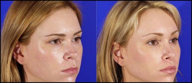 https://up.rozbano.com/view/3070775/Non-surgical%20techniques%20for%20facial%20skin%20rejuvenation.jpg