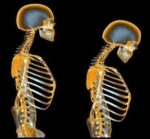 پوکی‌استخوان و راه‌های درمان آن - Osteoporosis20and20its20treatment20methods 02