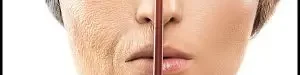 What20causes20premature20skin20aging20and20how20to20treat20it-03