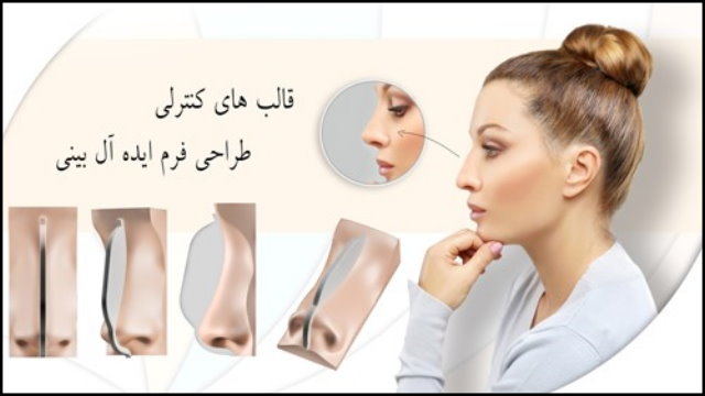 https://up.rozbano.com/view/2687203/bini.jpg
