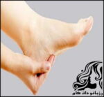 روش هایی برای درمان ترک پاشنه - rozbano 144 2