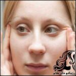 جلوگیری از افتادگی پوست - rozbano 157 1 2