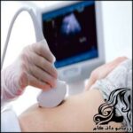 احکام سونوگرافی زن توسط مرد! - rozbano 221 2