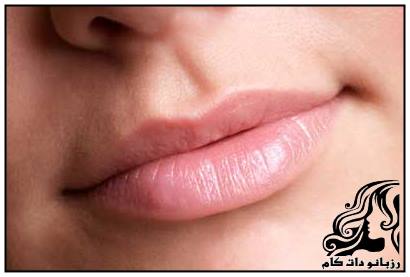 لب های برجسته و زیبا داشته باشید - rozbano 235 19