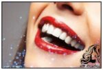 تکنیک های آرایشی برای سفید کردن دندان - rozbano 288 3