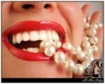 خوب و بد اصلاح طرح لبخند - rozbano 348 11