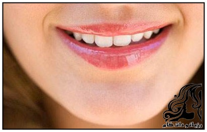 روش هایی برای حجم دادن به لب ها - rozbano 43 5