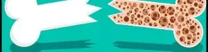 sport20and20preventing20osteoporosis-02