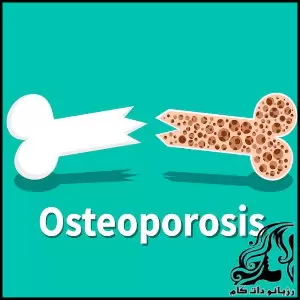 ورزش و جلوگیری از پوکی استخوان - sport20and20preventing20osteoporosis 02