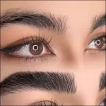 کاشت ابرو، راه ‌حل دائمی برای فرم دادن به چهره بدون تتو و میکروبلیدینگ - Eyebrow20transplantation20shaping20the20face 02