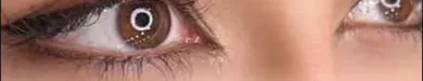 Eyebrow20transplantation20shaping20the20face-02