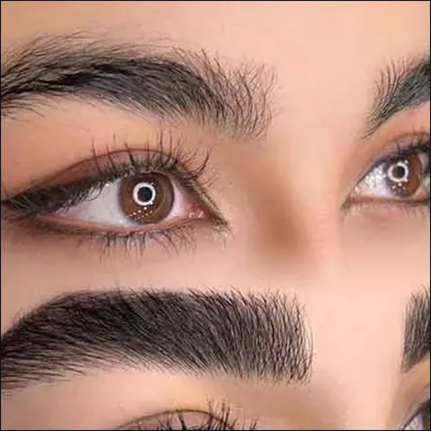 کاشت ابرو، راه حل دائمی برای فرم دادن به چهره بدون تتو و میکروبلیدینگ - Eyebrow20transplantation20shaping20the20face 02