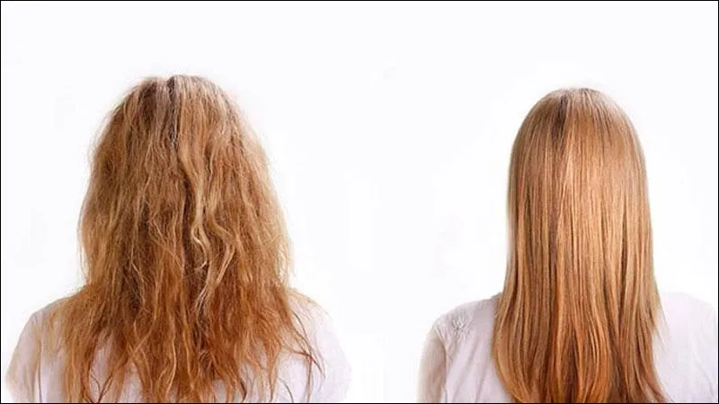 انجام مراقبت های بعد پروتئین